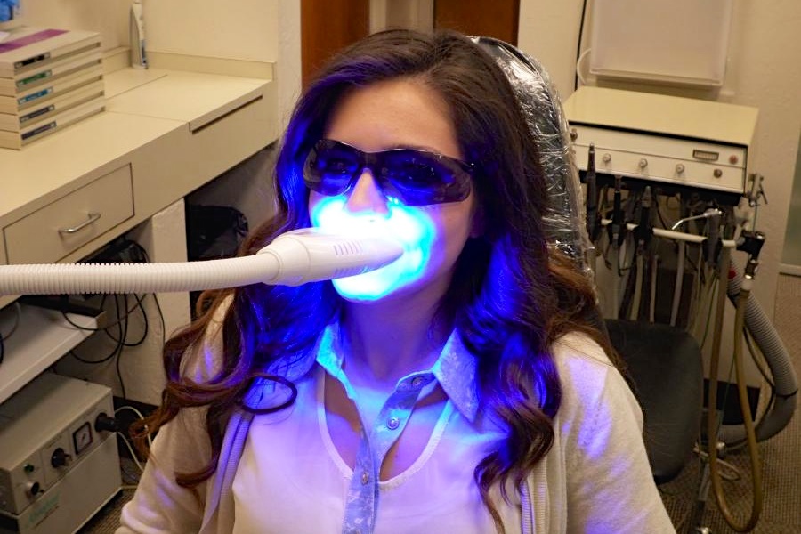 in office teeth whitening